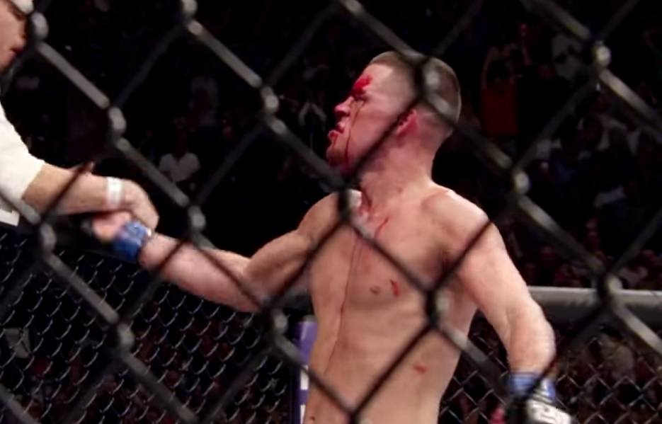 Nate Diaz