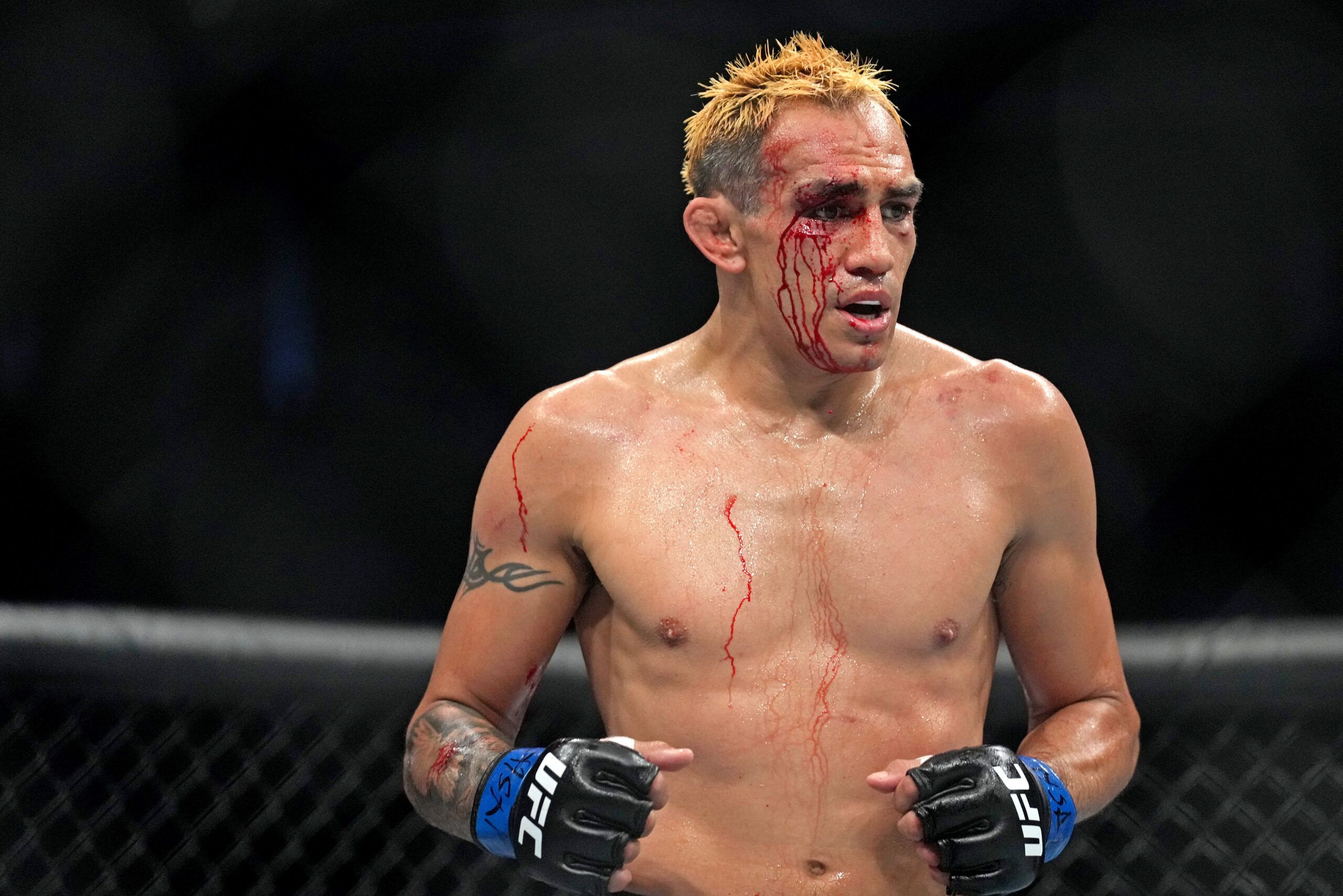tony ferguson