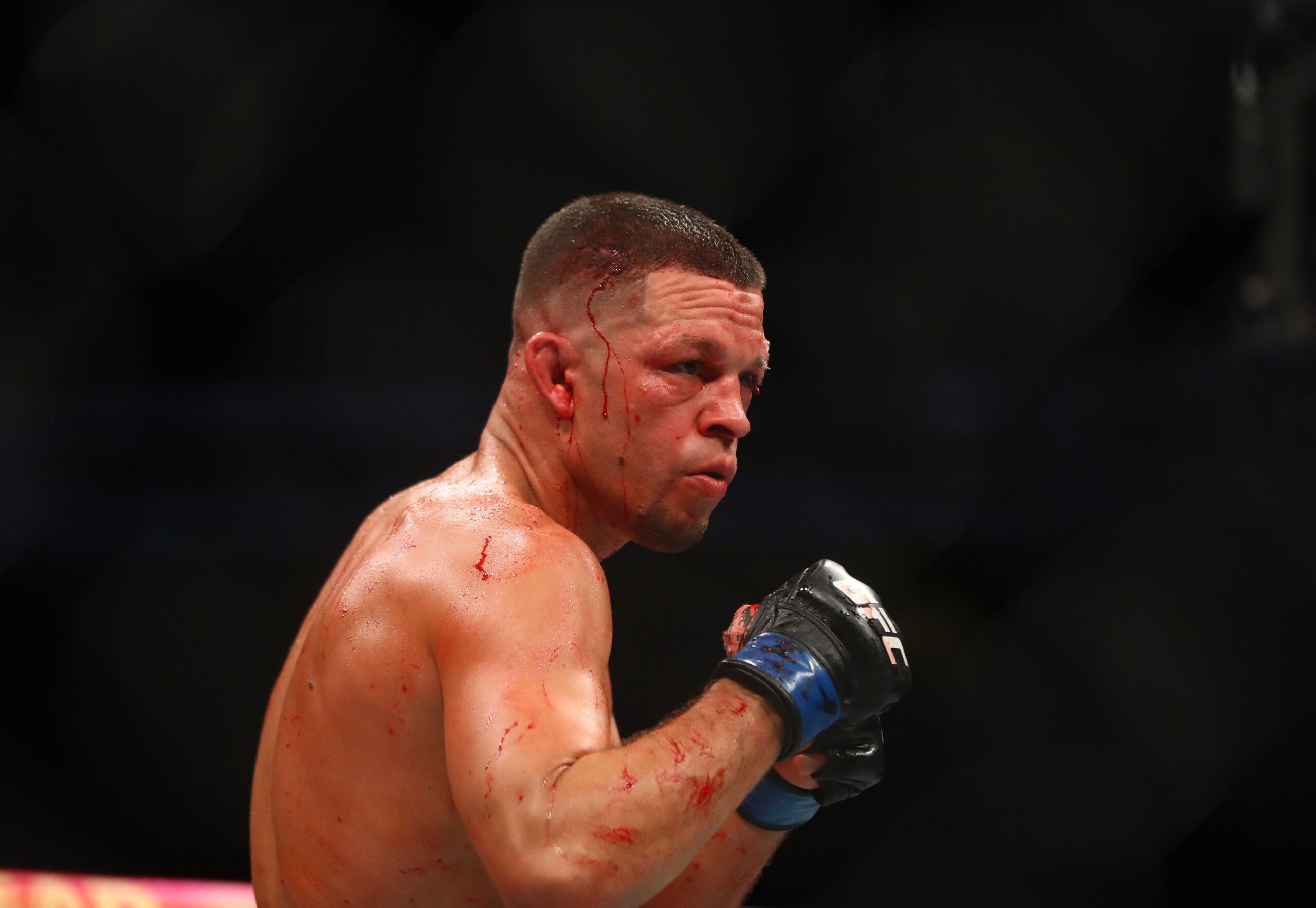 Nate Diaz