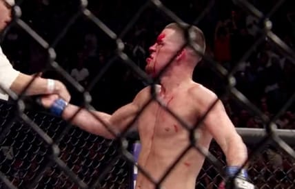 Nate Diaz