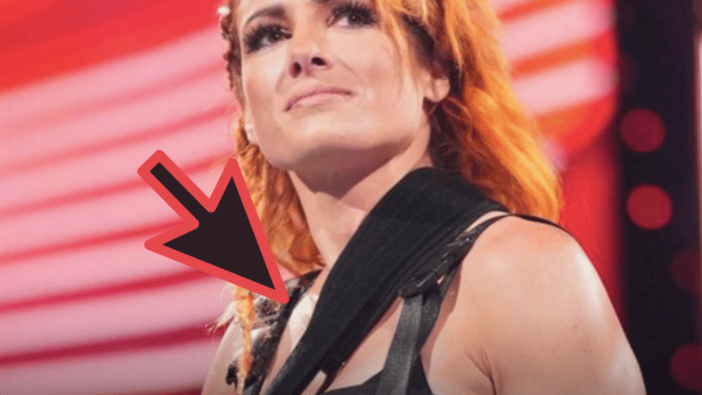 Becky Lynch Injury